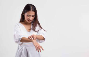 Perawatan Dermatitis Atopik (Eksim): Medis hingga Alami