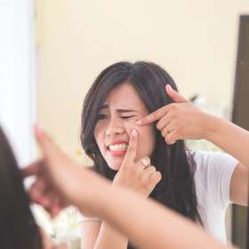 Apakah Bisa Menghilangkan Bekas Jerawat Dengan Microneedling?