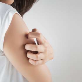 Waspadai Penyebab Psoriasis pada Kulit dan Gejalanya