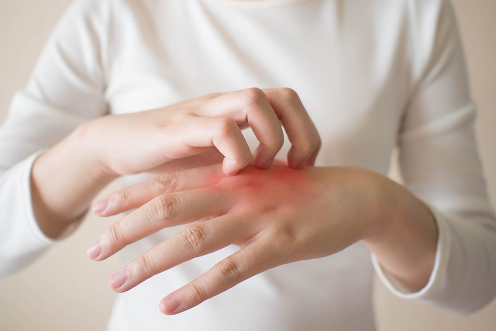 Perbedaan Psoriasis dan Eksim