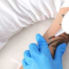 Mudah! Ini Dia Cara Menghapus Tato Permanen