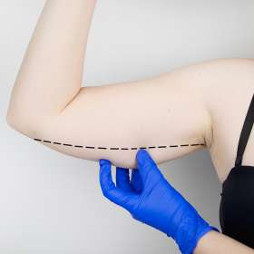 Perawatan Body Contouring untuk Menghilangkan Lemak