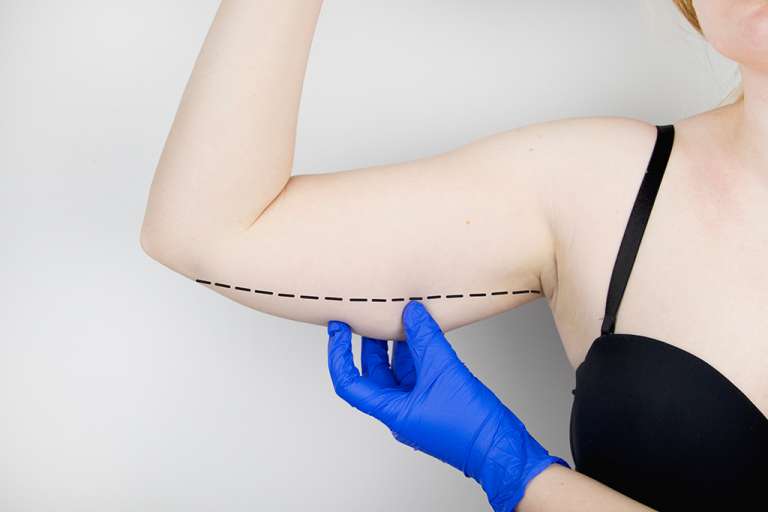 Perawatan Body Contouring untuk Menghilangkan Lemak