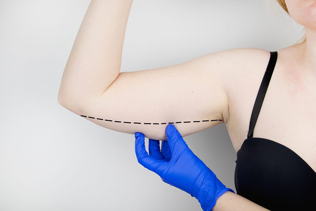 perawatan body contouring