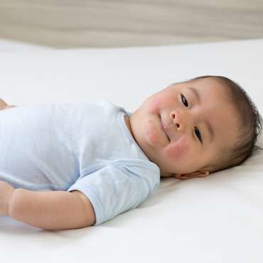Jerawat pada Bayi