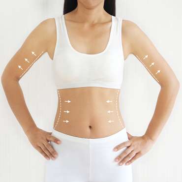 Apa Saja Jenis-Jenis Perawatan Body Contouring?