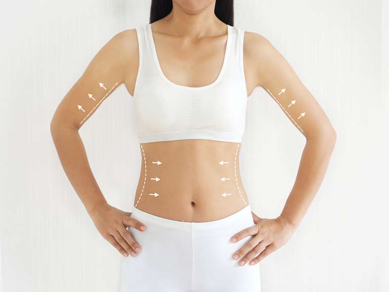 Apa Saja Jenis-Jenis Perawatan Body Contouring?