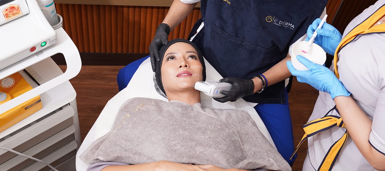 ultherapy zoom in
