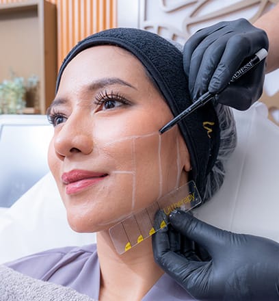 ultherapy