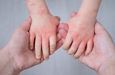 eksim adalah