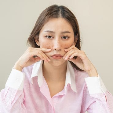 Kenali 6 Ciri Kulit Sensitif dan Cara Merawatnya