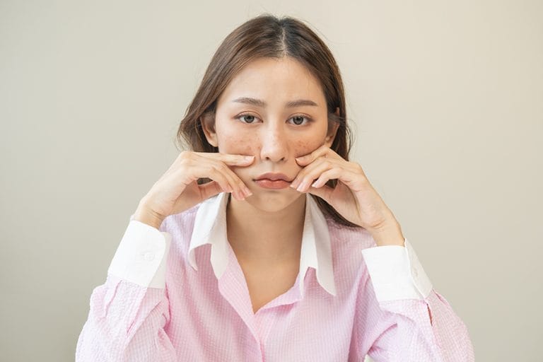 Kenali 6 Ciri Kulit Sensitif dan Cara Merawatnya