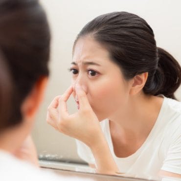 7 Penyebab Komedo Hitam di Hidung dan Cara Mengatasinya