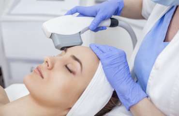 Pulsed Dye Laser untuk pengobatan psoriasis