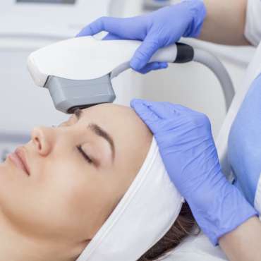 Fungsi Pulsed Dye Laser VBeam untuk Mengatasi Psoriasis