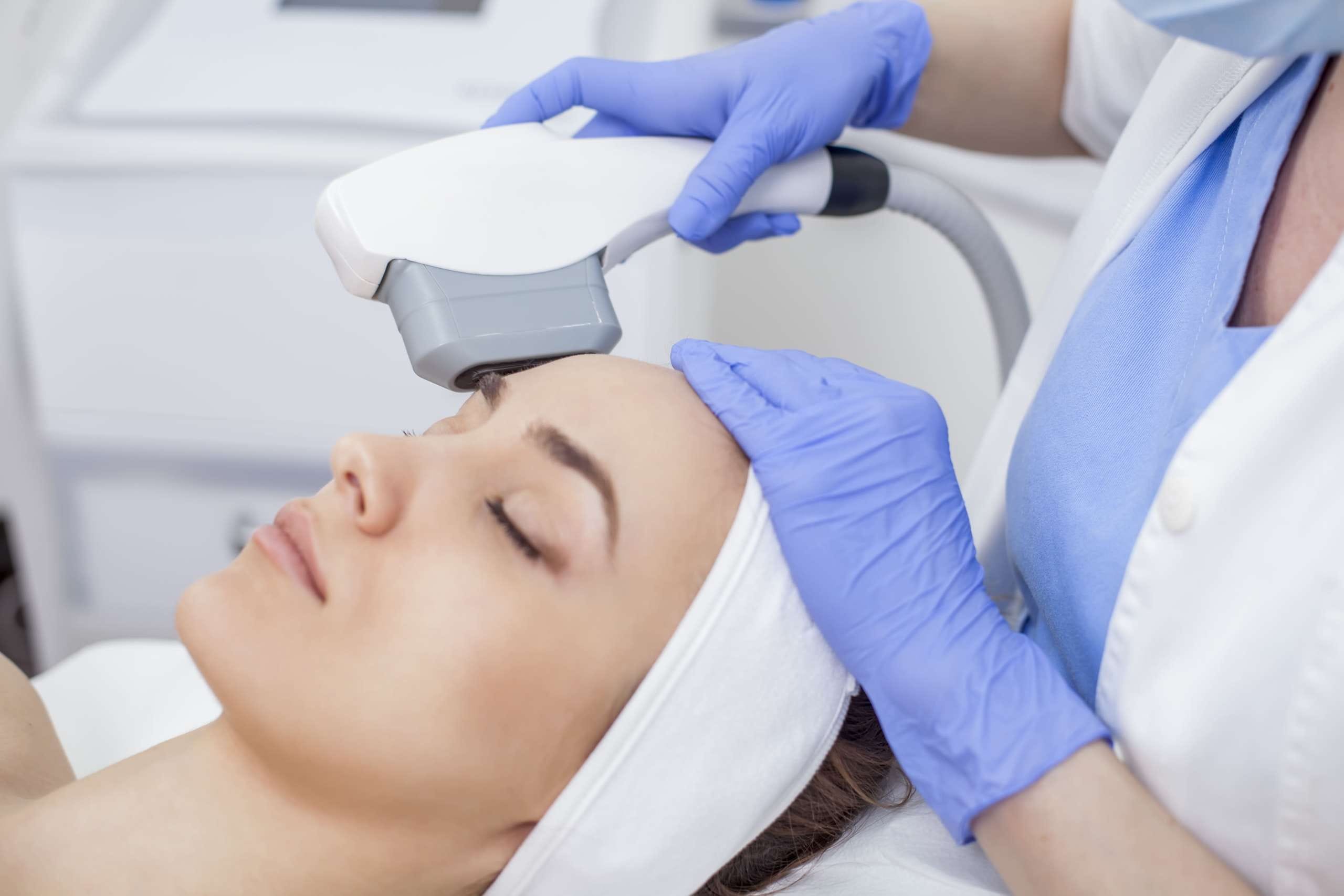 Pulsed Dye Laser untuk pengobatan psoriasis
