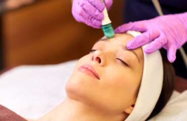 Crystal Microdermabrasion Crystal Microdermabrasion