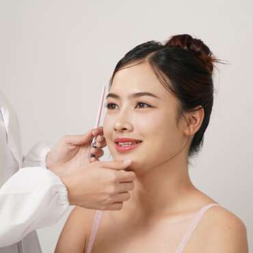 Kenali Apa Itu Botox Cuping Hidung, Tujuan, hingga Prosedur
