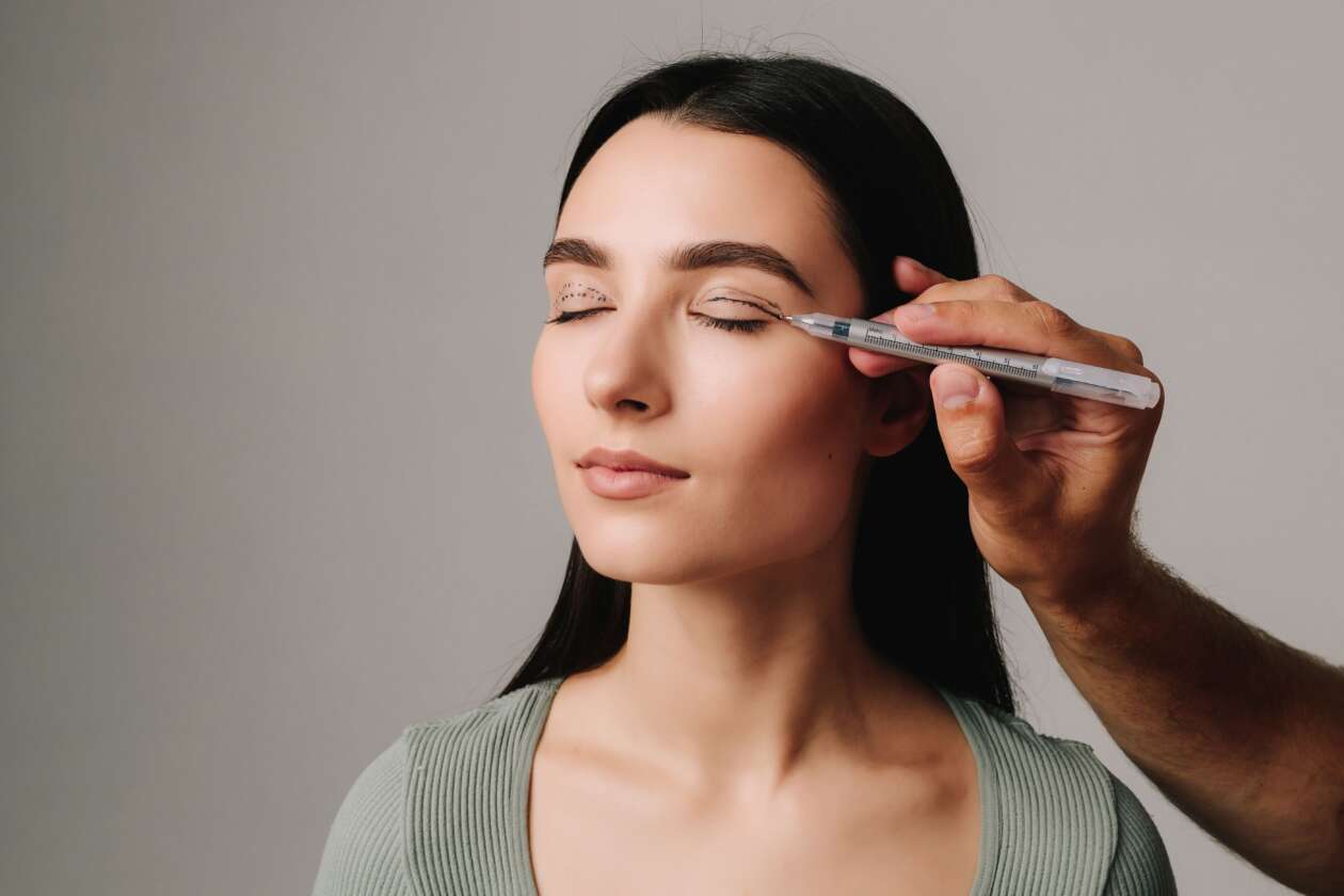 Blepharoplasty