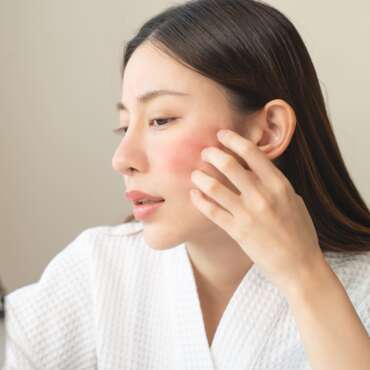 Macam-Macam Dermatitis, Gejala dan Cara Mengatasinya