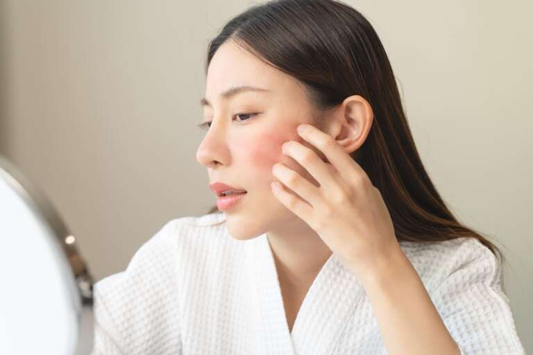 Macam-Macam Dermatitis, Gejala dan Cara Mengatasinya