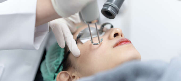 Laser CO2 Fractional